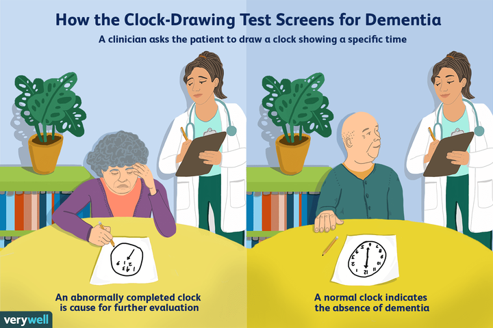 clock-drawing-test.png